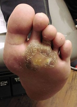 Before SWIFT Treatment
